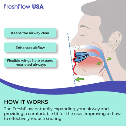 FreshFlow™ USA Anti-Snoring Mouthpiece | Flash Sale